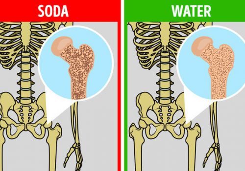 Tưởng chừng lành mạnh nhưng 7 loại thực phẩm này ẩn chứa những hiểm họa khôn lường cho sức khỏe bạn